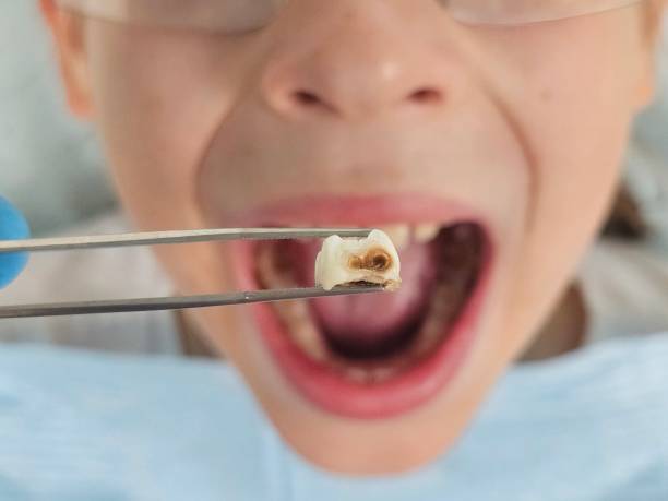 Best Emergency Root Canal Therapy in Ray City, GA